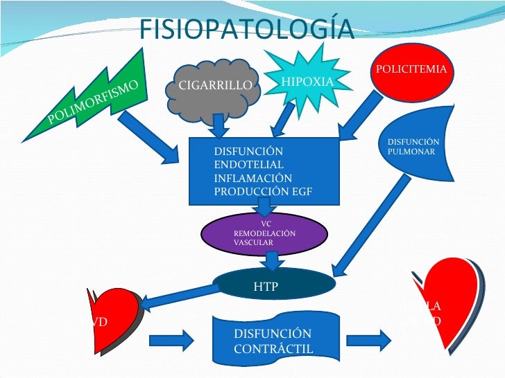 HIPERTENSION PULMONAR