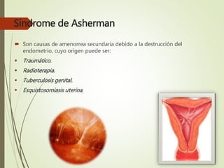 Síndrome de Asherman
 Son causas de amenorrea secundaria debido a la destrucción del
endometrio, cuyo origen puede ser:
 Traumático.
 Radioterapia.
 Tuberculosis genital.
 Esquistosomiasis uterina.
 