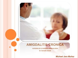 AMIGDALITIS CRONICA
CATEDRA DE OTORRINOLARINGOLOGIA
Dr. Gonzalo Zabala

Michael Jara Muñoz

 