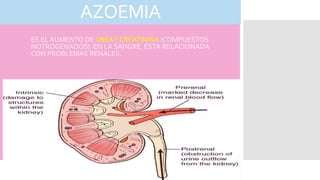 AZOEMIA
ES EL AUMENTO DE UREAY CREATININA (COMPUESTOS
NOTROGENADOS) EN LA SANGRE, ESTA RELACIONADA
CON PROBLEMAS RENALES.
 