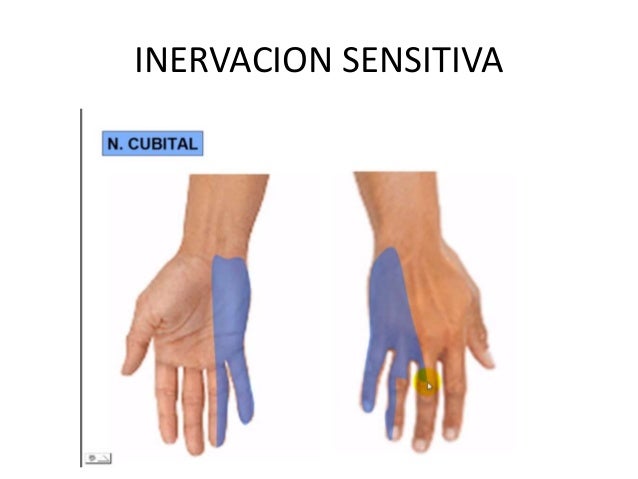 NERVIO CUBITAL - BRAZO