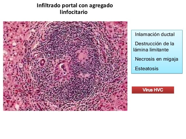Como sanar la última fase del alcoholismo