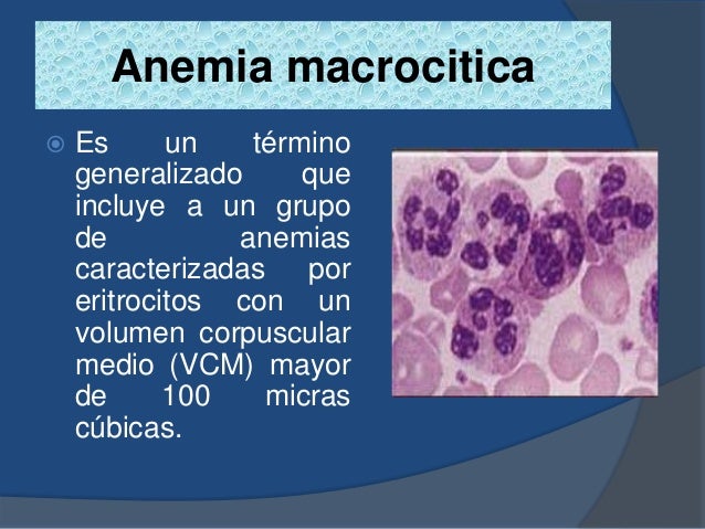 Anemia en el embarazo