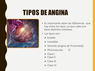 TIPOS DE ANGINA
• Es importante saber las diferencias que
hay entre los tipos, ya que cada uno
tiene distintos síntomas.
• Los tipos son:
 Estable
 Inestable
 Variante (angina de Prinzmetal)
 Microvascular. O
 Clase I
 Clase II
 Clase III
 Clase IV
 