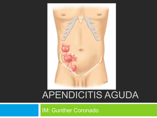 APENDICITIS AGUDA
IM: Gunther Coronado
 