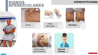 APENDICITIS.pptx