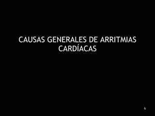 CAUSAS GENERALES DE ARRITMIAS CARDÍACAS 