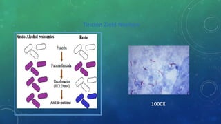 Tinción Ziehl Neelsen
1000X
 