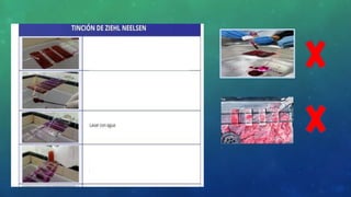 Cubrir con fucsina
fenicada
Calentar hasta emisión de
vapores tres veces
durante 5 minutos
Lavar con agua
Cubrir con decolorante
durante 3 minutos (Repetir
este paso si es necesario)
 