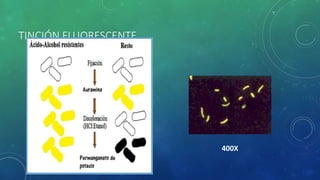 TINCIÓN FLUORESCENTE
400X
 
