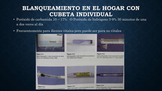 BLANQUEAMIENTO EN EL HOGAR CON
CUBETA INDIVIDUAL
• Peróxido de carbamida 10 – 17%. O Peróxido de hidrógeno 3-9% 30 minutos de una
a dos veces al día
• Frecuentemente para dientes vitales pero puede ser para no vitales
 