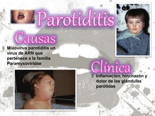 Patologias de Boca | PPTX