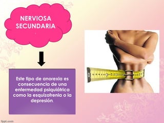 NERVIOSA
 SECUNDARIA
         .




 Este tipo de anorexia es
  consecuencia de una
 enfermedad psiquiátrica
como la esquizofrenia o la
         depresión.
 