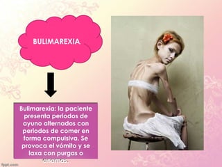 BULIMAREXIA.




Bulimarexia: la paciente
  presenta periodos de
 ayuno alternados con
 periodos de comer en
 forma compulsiva. Se
 provoca el vómito y se
   laxa con purgas o
        enemas.
 