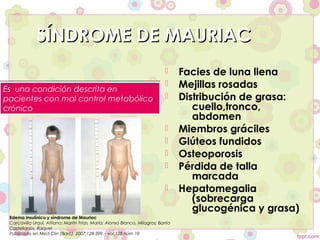 SÍNDROME DE MAURIAC
                                                                                  Facies de luna llena
Es una condición descrita en
                                                                                  Mejillas rosadas
pacientes con mal control metabólico                                              Distribución de grasa:
crónico                                                                               cuello,tronco,
                                                                                      abdomen
                                                                                  Miembros gráciles
                                                                                  Glúteos fundidos
                                                                                  Osteoporosis
                                                                                  Pérdida de talla
                                                                                      marcada
                                                                                  Hepatomegalia
                                                                                      (sobrecarga
                                                                                      glucogénica y grasa)
 Edema insulínico y síndrome de Mauriac
 Carcavilla Urquí, Atilano; Martín Frías, María; Alonso Blanco, Milagros; Barrio
 Castellanos, Raquel
 Publicado en Med Clin (Barc). 2007;128:399. - vol.128 núm 10
 