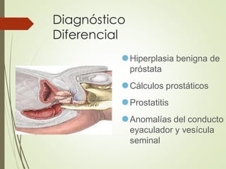 Diagnóstico
Diferencial
⚫Hiperplasia benigna de
próstata
⚫Cálculos prostáticos
⚫Prostatitis
⚫Anomalías del conducto
eyaculador y vesícula
seminal
 