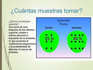¿Cuántas muestras tomar?
¿Qué es una biopsia
sextante?
Una serie de seis
biopsias de los lóbulos
superior, medio e
inferior derecho e
izquierdo de la próstata,
lo que aumenta el
rendimiento diagnóstico
y la probabilidad de
detectar el cáncer de
próstata .
 