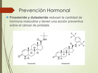 Prevención Hormonal
⚫ Finasteride y dutasteride reducen la cantidad de
hormona masculina y tienen una acción preventiva
sobre el cáncer de próstata
 