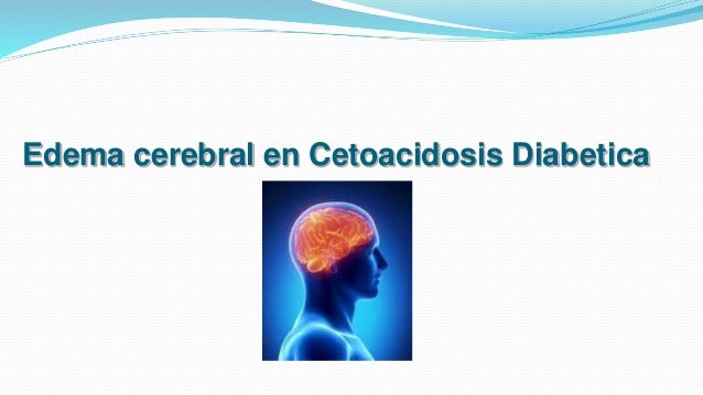 Cetoacidosis Diabetica Cetoacidosis Diabetica