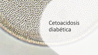Cetoacidosis
diabética
 