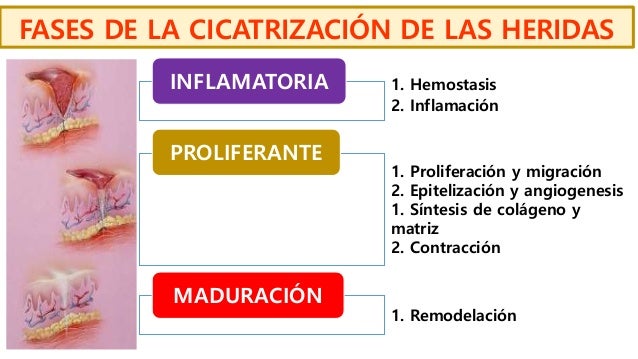 CICATRIZACION DE LAS HERIDAS