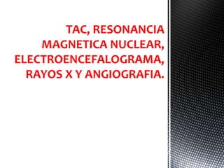 TAC, RESONANCIA
MAGNETICA NUCLEAR,
ELECTROENCEFALOGRAMA,
RAYOS X Y ANGIOGRAFIA.
 