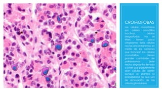 CROMOFOBAS
Las células cromófobas
son células cromófilas
inactivas, células
desgastadas. No se
tiñen, tienen poco
citoplasma; Estás células
nos las encontraremos en
medio de los cordones
que formarán las células
cromofólilas. tienen
grandes cantidades de
poliribosomas (este
hecho singular ha llevado
a creer que posiblemente
sean células de sostén
aunque se plantea la
probabilidad de que sea
de renovación de las
células glandulares.
 