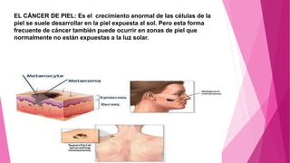EL CÁNCER DE PIEL: Es el crecimiento anormal de las células de la
piel se suele desarrollar en la piel expuesta al sol. Pero esta forma
frecuente de cáncer también puede ocurrir en zonas de piel que
normalmente no están expuestas a la luz solar.
 