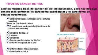 TIPOS DE CANCER DE PIEL
Existen muchos tipos de cáncer de piel no melanoma, pero hay dos que
son los más comunes: el carcinoma basocelular y el carcinoma de
células escamosas.
Carcinoma basocelular (cáncer de células
basales)
Tumor de crecimiento lento
El carcinoma espinocelular (carcinoma de
células escamosas)
Sarcoma de Kaposi
Linfoma
Sarcomas
Carcinoma de células de Merkel
tumores benignos de la piel
Enfermedades Precancerosas
Queratosis actínica
 