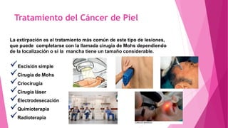 Tratamiento del Cáncer de Piel
La extirpación es el tratamiento más común de este tipo de lesiones,
que puede completarse con la llamada cirugía de Mohs dependiendo
de la localización o si la mancha tiene un tamaño considerable.
Escisión simple
Cirugía de Mohs
Criocirugía
Cirugía láser
Electrodesecación
Quimioterapia
Radioterapia
 