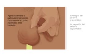 Patologías del
cordón
espermático
La palpación del
cordón
espermático
 