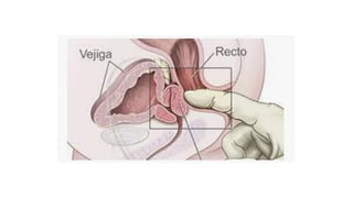 Expocisión Genitalesddddddddddddddd.pptx