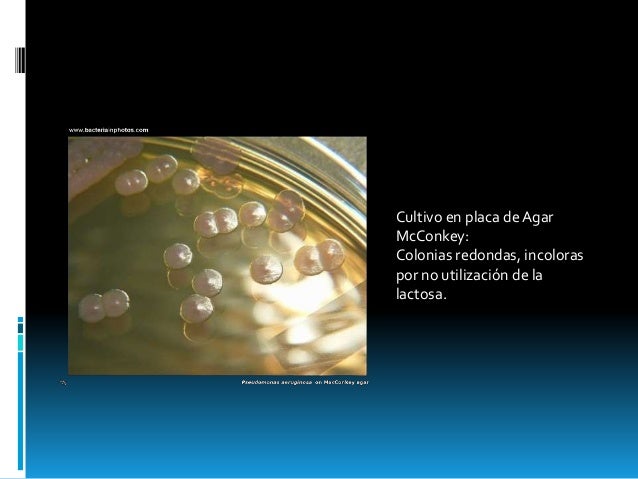 Pseudomona aeruginosa