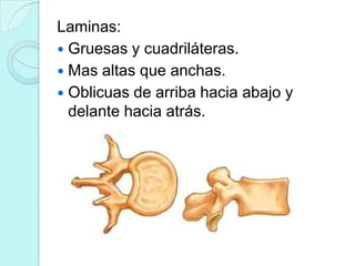 Laminas:
 Gruesas y cuadriláteras.
 Mas altas que anchas.
 Oblicuas de arriba hacia abajo y
  delante hacia atrás.
 