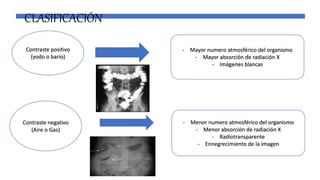 CLASIFICACIÓN
Contraste positivo
(yodo o bario)
Contraste negativo
(Aire o Gas)
- Mayor numero atmosférico del organismo
- Mayor absorción de radiación X
- Imágenes blancas
- Menor numero atmosférico del organismo
- Menor absorción de radiación X
- Radiotransparente
- Ennegrecimiento de la imagen
 