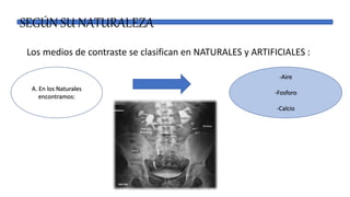 SEGÚN SU NATURALEZA
Los medios de contraste se clasifican en NATURALES y ARTIFICIALES :
A. En los Naturales
encontramos:
-Aire
-Fosforo
-Calcio
 