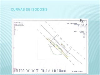CURVAS DE ISODOSIS 