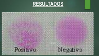 RESULTADOS
 