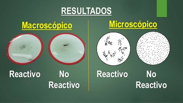 serología prueba no treponemica rpr & en suero no reactivo