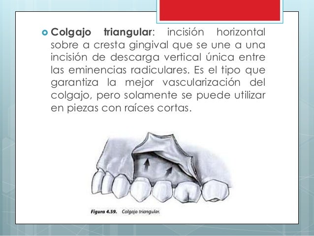 Expo de cirugia suturas y colgajos
