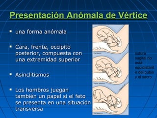 Presentación Anómala de VérticePresentación Anómala de Vértice
 una forma anómalauna forma anómala
 Cara, frente, occipitoCara, frente, occipito
posterior, compuesta conposterior, compuesta con
una extremidad superioruna extremidad superior
 AsinclitismosAsinclitismos
 Los hombros jueganLos hombros juegan
también un papel si el fetotambién un papel si el feto
se presenta en una situaciónse presenta en una situación
transversatransversa
sutura
sagital no
está
equidistant
e del pubis
y el sacro
 