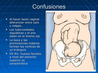 ConfusionesConfusiones
 Al hacer tacto vaginalAl hacer tacto vaginal
diferenciar entre caradiferenciar entre cara
y nalgas…y nalgas…
 Las tuberosidadesLas tuberosidades
isquiáticas y el anoisquiáticas y el ano
están en el mismo ejeestán en el mismo eje
 La boca y lasLa boca y las
prominencias malaresprominencias malares
forman los vertices deforman los vertices de
un triánguloun triángulo
 DX RX: huesos facialesDX RX: huesos faciales
a nivel del estrechoa nivel del estrecho
superior essuperior es
característicacaracterística
 