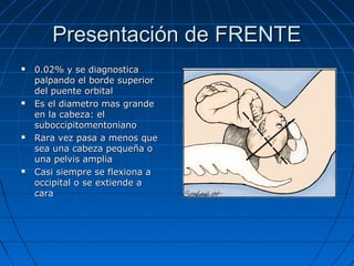 Presentación de FRENTEPresentación de FRENTE
 0.02% y se diagnostica0.02% y se diagnostica
palpando el borde superiorpalpando el borde superior
del puente orbitaldel puente orbital
 Es el diametro mas grandeEs el diametro mas grande
en la cabeza: elen la cabeza: el
suboccipitomentonianosuboccipitomentoniano
 Rara vez pasa a menos queRara vez pasa a menos que
sea una cabeza pequeña osea una cabeza pequeña o
una pelvis ampliauna pelvis amplia
 Casi siempre se flexiona aCasi siempre se flexiona a
occipital o se extiende aoccipital o se extiende a
caracara
 