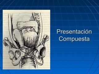 PresentaciónPresentación
CompuestaCompuesta
 