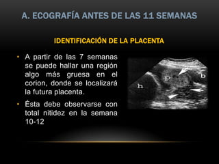 A. ECOGRAFÍA ANTES DE LAS 11 SEMANAS

          IDENTIFICACIÓN DE LA PLACENTA

• A partir de las 7 semanas
  se puede hallar una región
  algo más gruesa en el
  corion, donde se localizará
  la futura placenta.
• Ésta debe observarse con
  total nitidez en la semana
  10-12
 