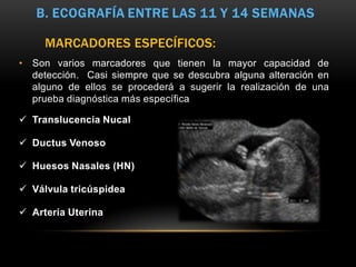 MARCADORES ESPECÍFICOS:
• Son varios marcadores que tienen la mayor capacidad de
  detección. Casi siempre que se descubra alguna alteración en
  alguno de ellos se procederá a sugerir la realización de una
  prueba diagnóstica más específica

 Translucencia Nucal

 Ductus Venoso

 Huesos Nasales (HN)

 Válvula tricúspidea

 Arteria Uterina
 