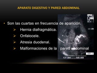 APARATO DIGESTIVO Y PARED ABDOMINAL



• Son las cuartas en frecuencia de aparición.
         Hernia diafragmática.
         Onfalocele.
         Atresia duodenal.
         Malformaciones de la pared abdominal
 
