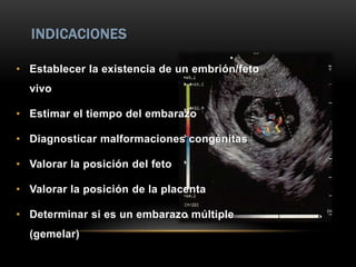 INDICACIONES

• Establecer la existencia de un embrión/feto
  vivo

• Estimar el tiempo del embarazo

• Diagnosticar malformaciones congénitas

• Valorar la posición del feto

• Valorar la posición de la placenta

• Determinar si es un embarazo múltiple
  (gemelar)
 