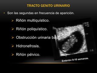 TRACTO GENITO URINARIO
• Son las segundas en frecuencia de aparición.

      Riñón multiquístico.

      Riñón poliquístico.

      Obstrucción urinaria baja.

      Hidronefrosis.

      Riñón pélvico.
 