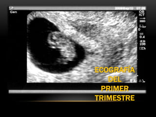 ECOGRAFÍA
   DEL
 PRIMER
TRIMESTRE
 